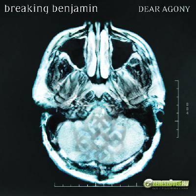 Breaking Benjamin -  Dear Agony